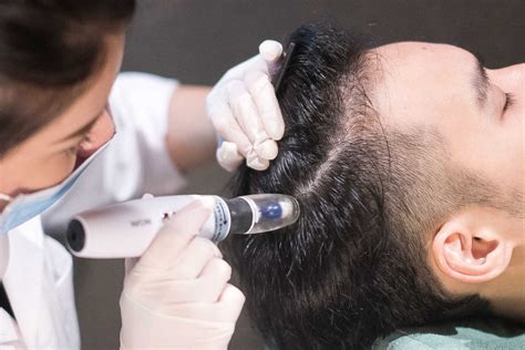 Get The Best Mesotherapy For Hair In Pune At A Low Cost Bodysutra Clinic