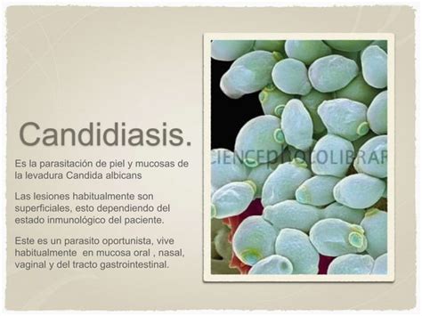 Micosis Superficiales Y Candidiasis Ppt