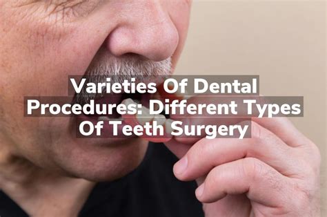 Varieties of Dental Procedures: Different Types of Teeth Surgery | New ...