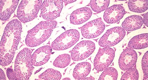 Photomicrograph Of The Testicular Tissue Of Mice In Selenium Treated