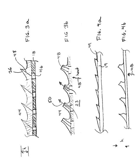 Intravascular catheter patented technology retrieval search results