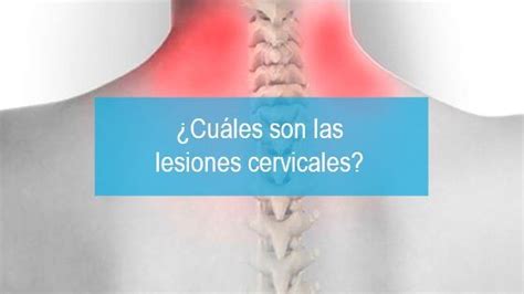 Cuáles son las lesiones cervicales