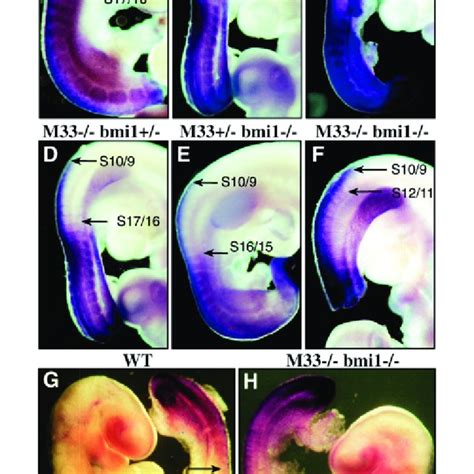 Expression Of Hoxc In Dpc Embryos Lateral View Of Sagittal