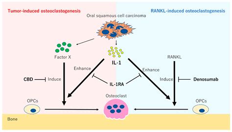 Il Generated By Oral Squamous Cell Carcinoma Stimulates Tumor Induced