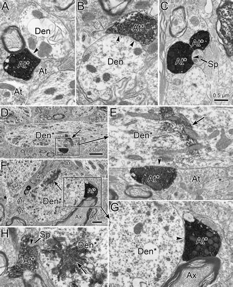 Ultrastructure Of Mrf Terminals Within Cc The Bda Reaction Product