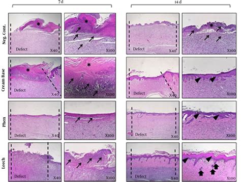 Histopathological Analysis H And E Stained Microscopic Sections Of Skin