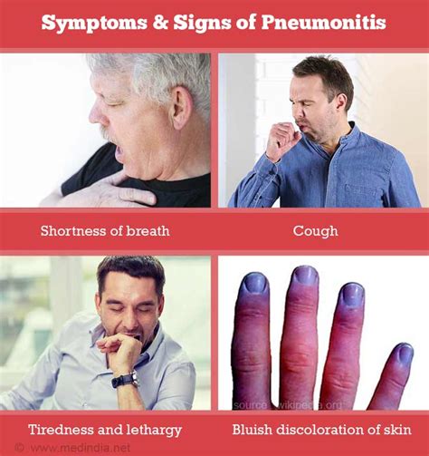 Symptoms and Signs of Pneumonitis