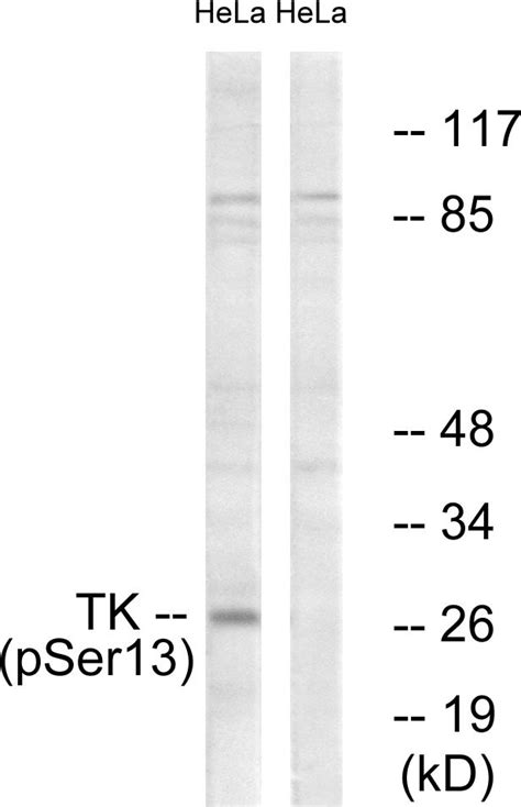 Anti TK1 TK Thymidine Kinase Antibody Rabbit Anti Human LSBio