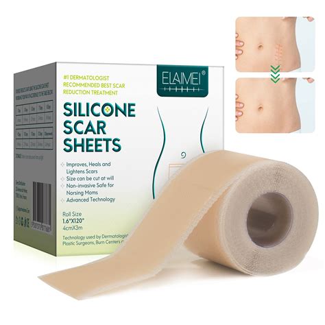 Medical Grade Silicone Scar Tape Roll - 1.6x120 | Professional Scar ...