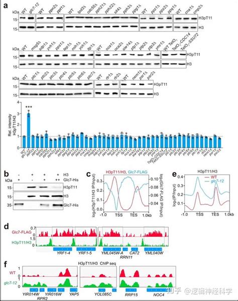 Cell Discov︱湖北大学李珊珊 余希岚团李珊珊 余希岚团队发现糖代谢调控自噬与端粒结构的新机制 知乎