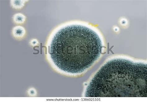 Colonies Penicillium Fungi Grown On Sabouraud Stock Photo 1386021101