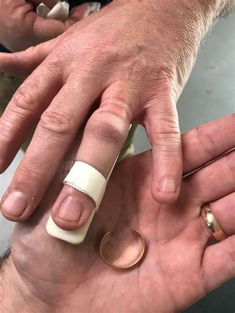 Trumbull Firefighters Save Man From His Wedding Ring