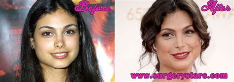 Morena Baccarin Plastic Surgery Before & After Pic