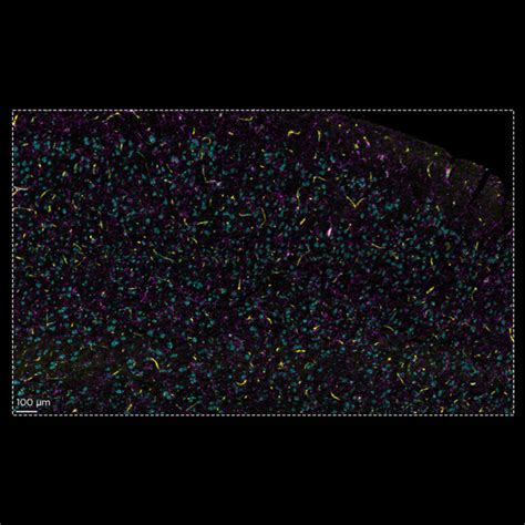 Lightsheet Imaging Lifecanvas Megaspim Cairn Research Ltd