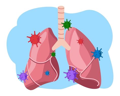 Contaminación Y Contaminación Por Virus En Los Pulmones Vector Premium