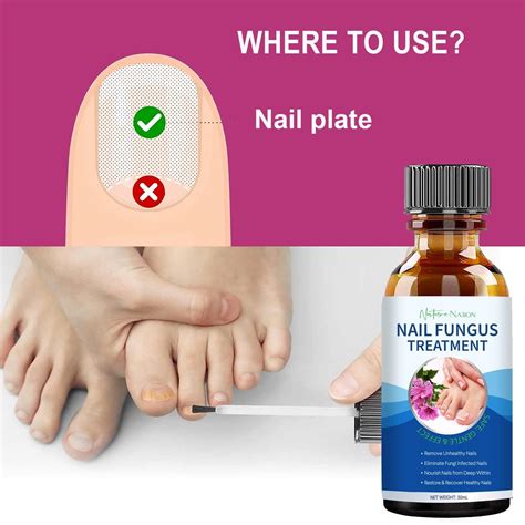 Extra Strength Toenail Fungus Treatment - Nail Repair Solution for