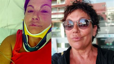 Donatella Milani La Foto Dall Ospedale Dopo L Incidente