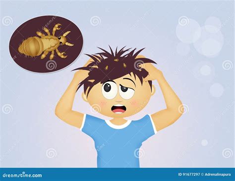 Child With Head Lice Stock Illustration Illustration Of Head 91677297