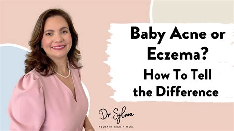 Baby Acne Or Eczema How To Tell The Difference Dr Sylma Youtube