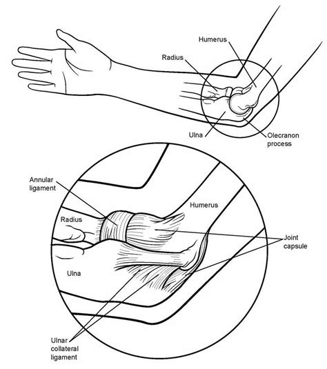 Golfers Elbow Causes Symptoms Diagnosis Treatment Exercises