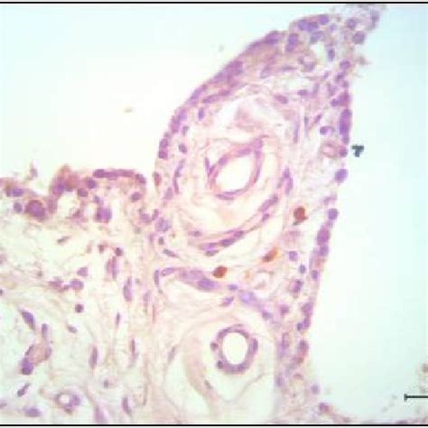 Isolated MCs presents in the sublining of knee synovium, stained with... | Download Scientific ...