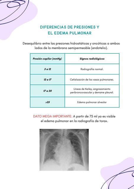 Diferencias De Presiones Y El Edema Pulmonar Maryuri Lisbeth Udocz