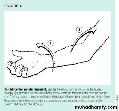 Signs of dislocated elbow: Dislocated Elbow Symptoms, Causes, and Treatment