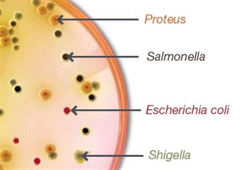 Salmonella Shigella Agar Scheda Del Terreno Di Coltura Per Microbiologia