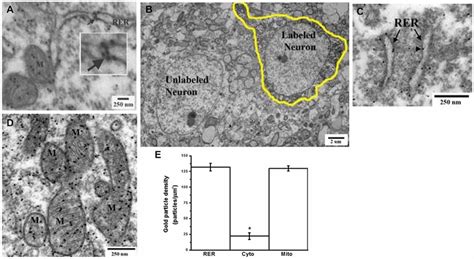 Electron Microscopy Immunogold Labeling Demonstrates The Presence Of