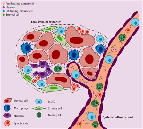 Cancer Related Inflammation And Treatment Effectiveness The Lancet Oncology