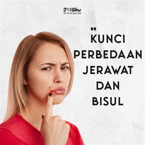 Kunci Perbedaan Jerawat Dan Bisul Jglow Official