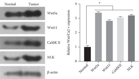 The Expression Of Atf 2 And Wnt Pathway Proteins In Lung Cancer Tissues