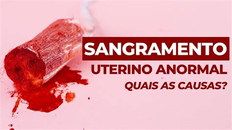 Quais As Causas Do Sangramento Uterino Anormal YouTube