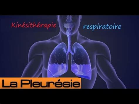 La pleurésie et sa prise en charge kinésithérapique - YouTube