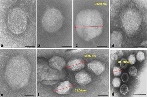 Tem Images Of Presumptive Naked Adenoviridae Like Particles And G A