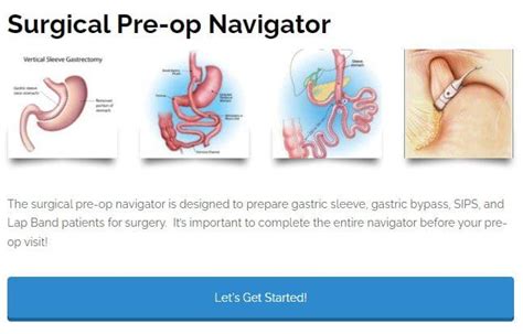 Surgical Preop Navigator Journeylite Weight Loss Plastics And Spine