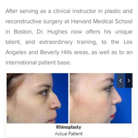 Rhinoplasty Perfection With Dr Kenneth Hughes In Los Angeles Plastic