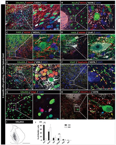 Derivation Of Sendai Virus Reprogrammed Human Ipscs Neuronal Precursors