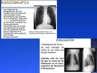 Asma Bronquial En Pediatria Jul Pptx Descarga Gratuita