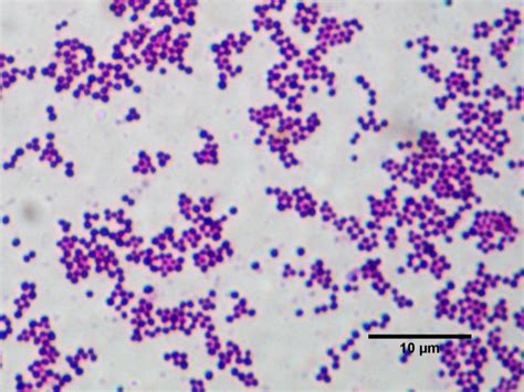 Staphylococcus aureus