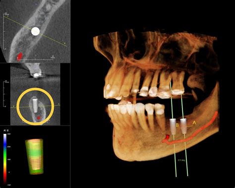 X Ray Justification Dental Scanning Services Ct Dent Ltd