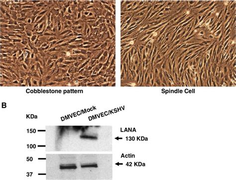 Results Using Human Dermal Microvascular Endothelial Cells Dmvec That