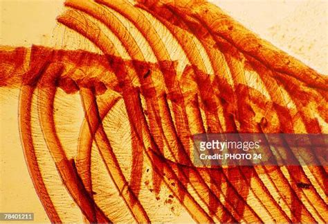 Rib Cage Pattern Photos And Premium High Res Pictures Getty Images