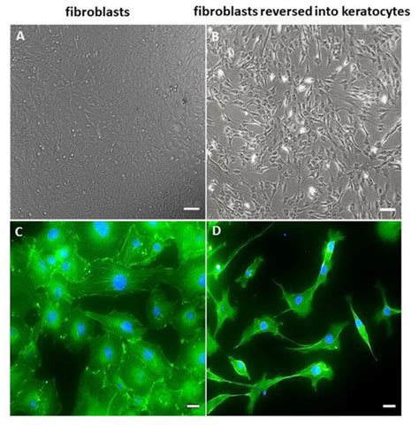 Ijms Free Full Text Derivation Of Human Corneal Keratocytes From