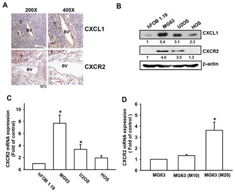 Cancers Free Full Text Cxcl Cxcr Paracrine Axis Contributes To