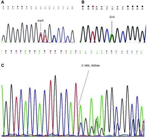 Dna Chromatogram