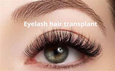 Eyelash Hair Transplant In Mysore Reniu Clinic Dr Manas Jain