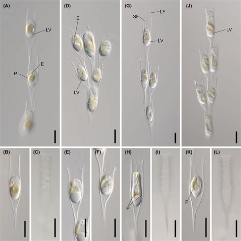 Frontiers Multigene Phylogeny Reveals A Cryptic Diversity In The