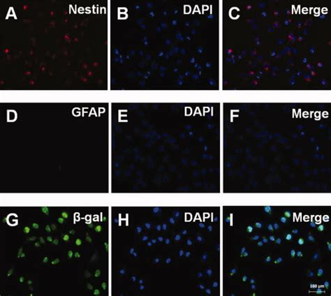 The Characterization Of Immortalized Human Neural Stem Cells Hb F