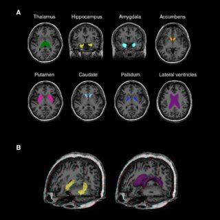 Subcortical structures evaluated in this study. (A) An example of the ...